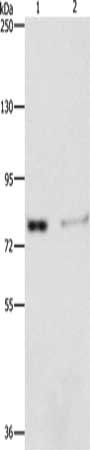 Gel: 10%SDS-PAGE, Lysate: 40 μg, Lane 1-2: Human fetal kidney tissue, 293T cells, Primary antibody: ASAH2 Antibody(ASAH2 Antibody) at dilution 1/240, Secondary antibody: Goat anti rabbit IgG at 1/8000 dilution, Exposure time: 5 minutesRabbit anti-Human ASAH2 Polyclonal Antibody