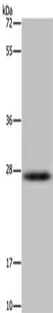 Gel: 10%SDS-PAGE, Lysate: 40 μg, Lane: Mouse kidney tissue, Primary antibody: HSD17B14 Antibody(HSD17B14 Antibody) at dilution 1/200, Secondary antibody: Goat anti rabbit IgG at 1/8000 dilution, Exposure time: 3 minutesRabbit anti-Human HSD17B14 Polyclonal Antibody
