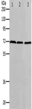 Gel: 10%SDS-PAGE, Lysate: 40 μg, Lane 1-3: K562 cells, hela cells, 293T cells, Primary antibody: PRMT5 Antibody(PRMT5 Antibody) at dilution 1/400, Secondary antibody: Goat anti rabbit IgG at 1/8000 dilution, Exposure time: 2 minutesRabbit anti-Human PRMT5 Polyclonal Antibody