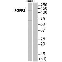 Western blot analysis of extracts from A549 cells, using FGFR2 antibody.Rabbit anti-Human FGFR2 Polyclonal Antibody