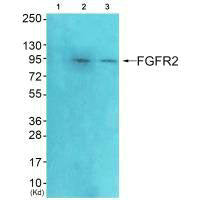 Western blot analysis of extracts from HeLa cells (Lane 2) and A549 cells (Lane 3), using FGFR2 antiobdy. The lane on the left is treated with systhesized peptide.Rabbit anti-Human FGFR2 Polyclonal Antibody