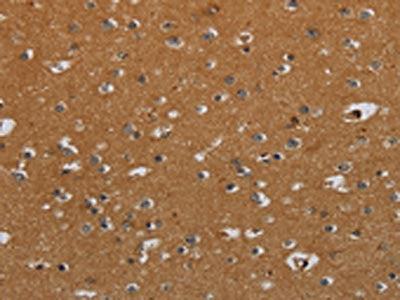 The image on the left is immunohistochemistry of paraffin-embedded Human brain tissue using the antibody Antibody) at dilution 1/40, on the right is treated with fusion protein. (Original magnification: ×200)Rabbit anti-Human CSH1 Polyclonal Antibody