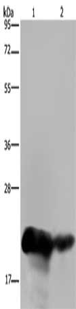 Gel: 10%SDS-PAGE, Lysate: 40 μg, Lane 1-2: Human placenta tissue, Human breast infiltrative duct tissue, Primary antibody: CSH1 Antibody(CSH1 Antibody) at dilution 1/200, Secondary antibody: Goat anti rabbit IgG at 1/8000 dilution, Exposure time: 10 secondsRabbit anti-Human CSH1 Polyclonal Antibody