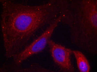 Immunofluorescence staining of methanol-fixed Hela cells using PAK1(Phospho-Thr212) Antibody.Rabbit anti-Human PAK1 Polyclonal Antibody