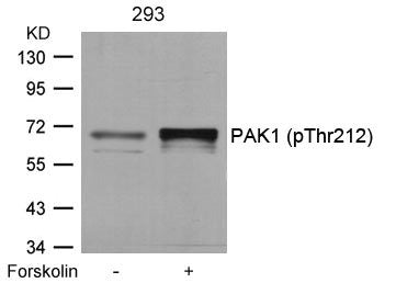 Western blot analysis of extracts from 293 cells untreated or treated with forskolin using PAK1(Phospho-Thr212) Antibody.Rabbit anti-Human PAK1 Polyclonal Antibody