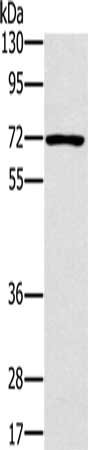 Gel: 8%SDS-PAGE, Lysate: 40 μg, Lane: Raji cells, Primary antibody: PLS3 Antibody(PLS3 Antibody) at dilution 1/400, Secondary antibody: Goat anti rabbit IgG at 1/8000 dilution, Exposure time: 2 minutesRabbit anti-Human PLS3 Polyclonal Antibody