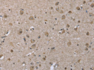 The image on the left is immunohistochemistry of paraffin-embedded Human brain  tissue using DYNLL1 Antibody(DYNLL1 Antibody) at dilution 1/25, on the right is treated with fusion protein. (Original magnification: ×200)Rabbit anti-Human DYNLL1 Polyclonal Antibody