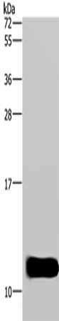 Gel: 10%SDS-PAGE, Lysate: 40 μg, Lane: Mouse brain tissue, Primary antibody: DYNLL1 Antibody(DYNLL1 Antibody) at dilution 1/600, Secondary antibody: Goat anti rabbit IgG at 1/8000 dilution, Exposure time: 5 secondsRabbit anti-Human DYNLL1 Polyclonal Antibody