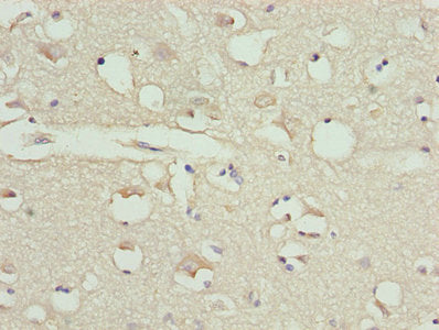 Immunohistochemistry of paraffin-embedded human brain tissue using CALR Antibody at dilution of 1:100
