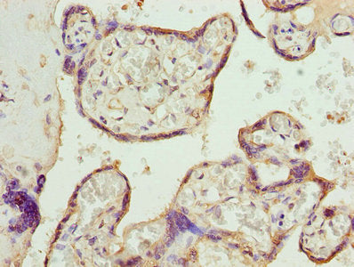 Immunohistochemistry of paraffin-embedded human placenta tissue using CALR Antibody at dilution of 1:100