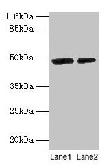 Western blot  | All lanes: CALR antibody at 2µg/ml  | Lane 1: EC109 whole cell lysate  | Lane 2: 293T whole cell lysate  | Secondary  | Goat polyclonal to rabbit IgG at 1/10000 dilution  | Predicted band size: 49 kDa  | Observed band size: 49 kDa