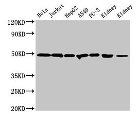 Western Blot  | Positive WB detected in: Hela whole cell lysate, Jurkat whole cell lysate, HepG2 whole cell lysate, A549 whole cell lysate, PC-3 whole cell lysate, Rat kidney tissue, Mouse kidney tissue  | All lanes: CALR antibody at 2µg/ml  | Secondary  | Goat polyclonal to rabbit IgG at 1/50000 dilution  | Predicted band size: 49 kDa  | Observed band size: 49 kDa