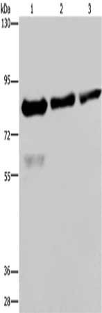 Gel: 6%SDS-PAGE, Lysate: 40 μg, Lane 1-3: Hela cells, LoVo cells, HepG2 cells, Primary antibody: FASTKD2 Antibody(FASTKD2 Antibody) at dilution 1/500, Secondary antibody: Goat anti rabbit IgG at 1/8000 dilution, Exposure time: 40 secondsRabbit anti-Human FASTKD2 Polyclonal Antibody