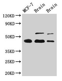 Western Blot  | Positive WB detected in: MCF-7 whole cell lysate, Rat brain tissue, Mouse brain tissue  | All lanes: TP53 antibody at 2.5µg/ml  | Secondary  | Goat polyclonal to rabbit IgG at 1/50000 dilution  | Predicted band size: 44, 38, 39, 40, 34, 35, 30, 24, 25 kDa  | Observed band size: 44 kDaRabbit anti-Human TP53 Polyclonal Antibody