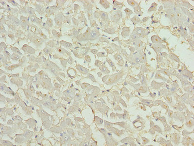 Immunohistochemistry of paraffin-embedded human heart tissue using MB Antibody at dilution of 1:100
