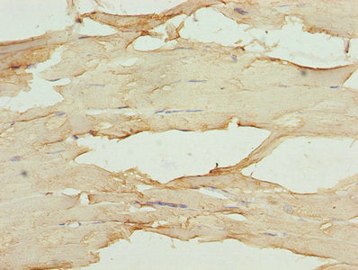 Immunohistochemistry of paraffin-embedded human skeletal muscle tissue using MB Antibody at dilution of 1:100