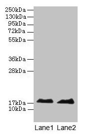 Western blot  | All lanes: MB antibody at 2µg/ml  | Lane 1: Rat skeletal muscle tissue  | Lane 2: Mouse heart tissue  | Secondary  | Goat polyclonal to rabbit IgG at 1/10000 dilution  | Predicted band size: 18 kDa  | Observed band size: 18 kDa