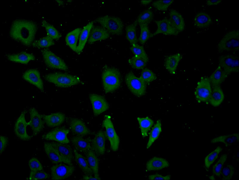 Immunofluorescence staining of Hela cell with NPPB Antibody at 1:30, counter-stained with DAPI. The cells were fixed in 4% formaldehyde and blocked in 10% normal Goat Serum. The cells were then incubated with the antibody overnight at 4C. The secondary antibody was Alexa Fluor 488-congugated AffiniPure Goat Anti-Rabbit IgG(H+L).Rabbit anti-Human NPPB Polyclonal Antibody