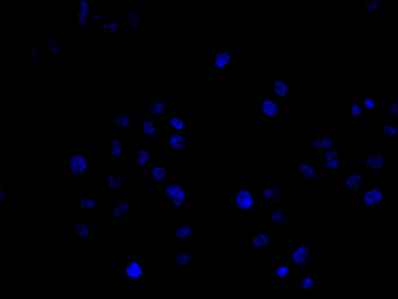 Immunofluorescence staining of Hela cell with 5% goat serum, counter-stained with DAPI. The cells were fixed in 4% formaldehyde and blocked in 10% normal Goat Serum. The cells were then incubated with the antibody overnight at 4C. The secondary antibody was Alexa Fluor 488-congugated AffiniPure Goat Anti-Rabbit IgG(H+L).Rabbit anti-Human NPPB Polyclonal Antibody
