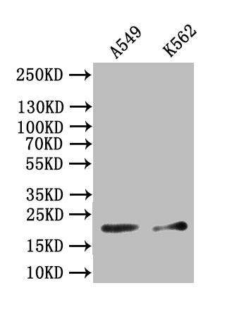 Western Blot Positive WB detected in: A549 whole cell lysate, K562 whole cell lysate All lanes: NPPB antibody at 1:1000 Secondary Goat polyclonal to rabbit IgG at 1/50000 dilution Predicted band size: 15-25 kDa Observed band size: 20 kDaRabbit anti-Human NPPB Polyclonal Antibody