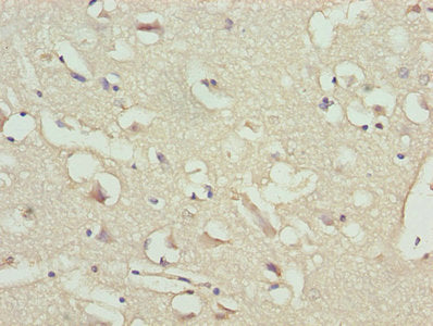 Immunohistochemistry of paraffin-embedded human brain tissue using NPPB Antibody at dilution of 1:100Rabbit anti-Human NPPB Polyclonal Antibody