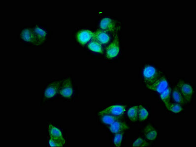 Immunofluorescence staining of Hela cells with the antibody at 1:200, counter-stained with DAPI. The cells were fixed in 4% formaldehyde, permeabilized using 0.2% Triton X-100 and blocked in 10% normal Goat Serum. The cells were then incubated with the antibody overnight at 4°C. The secondary antibody was Alexa Fluor 488-congugated AffiniPure Goat Anti-Rabbit IgG(H+L).Rabbit anti-Human TNNI3 Polyclonal Antibody