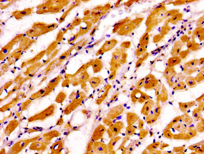Immunohistochemistry of paraffin-embedded human heart tissue using TNNI3 Antibody at dilution of 1:100Rabbit anti-Human TNNI3 Polyclonal Antibody