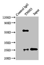 Immunoprecipitating TNNI3 in Rat heart tissue  | Lane 1: Rabbit control IgG instead of TNNI3 Antibody in Rat heart tissue. For western blotting, a HRP-conjugated Protein G antibody was used as the secondary antibody (1/5000)  | Lane 2: TNNI3 Antibody (8µg) + Rat heart tissue (500µg)  | Lane 3: Rat heart tissue (20µg)Rabbit anti-Human TNNI3 Polyclonal Antibody