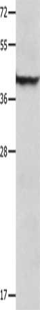Gel: 12%SDS-PAGE, Lysate: 40 μg, Lane: Mouse lung tissue, Primary antibody: SERPINB5 Antibody(SERPINB5 Antibody) at dilution 1/1000, Secondary antibody: Goat anti rabbit IgG at 1/8000 dilution, Exposure time: 10 secondsRabbit anti-Human SERPINB5 Polyclonal Antibody