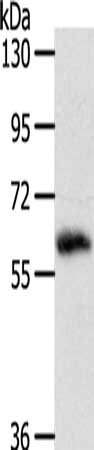 Gel: 10%SDS-PAGE, Lysate: 40 μg, Lane: PC3 cells, Primary antibody: SRC Antibody(SRC Antibody) at dilution 1/200, Secondary antibody: Goat anti rabbit IgG at 1/8000 dilution, Exposure time: 2 minutesRabbit anti-Human SRC Polyclonal Antibody