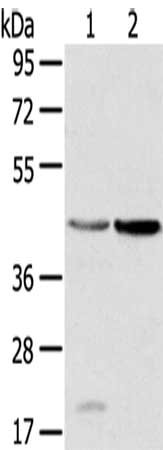 Gel: 8%SDS-PAGE,Lysate: 40 μg,Lane 1-2: Human placenta tissue, Human normal kidney tissue,Primary antibody: HSD11B2 Antibody(HSD11B2 Antibody) at dilution 1/200 dilution,Secondary antibody: Goat anti rabbit IgG at 1/8000 dilution,Exposure time: 30 secondsRabbit anti-Human HSD11B2 Polyclonal Antibody