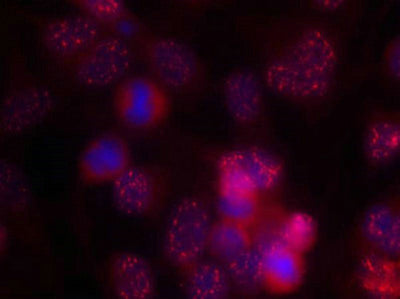 Immunofluorescence staining of methanol-fixed Hela cells using PKCd(Ab-645) Antibody.Rabbit anti-Human PRKCD Polyclonal Antibody