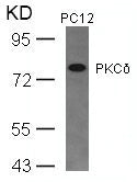 Western blot analysis of extracts from PC12 cells using PKCd(Ab-645) Antibody.Rabbit anti-Human PRKCD Polyclonal Antibody