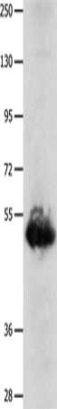 Gel: 8%SDS-PAGE, Lysate: 40 μg, Lane: Human lung cancer tissue, Primary antibody: BPIFB3 Antibody(BPIFB3 Antibody) at dilution 1/1600, Secondary antibody: Goat anti rabbit IgG at 1/8000 dilution, Exposure time: 30 seconds