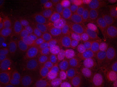 Immunofluorescence staining of methanol-fixed MCF cells using Estrogen Receptor-a(Phospho-Ser106) Antibody.Rabbit anti-Human ESR1 Polyclonal Antibody