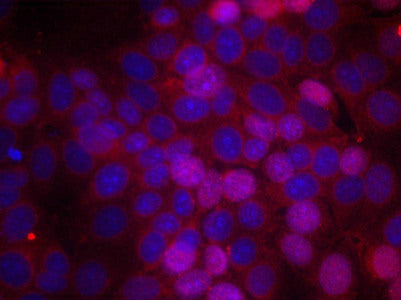 Immunofluorescence staining of methanol-fixed MCF cells using Estrogen Receptor-a(Phospho-Ser106) Antibody.Rabbit anti-Human ESR1 Polyclonal Antibody