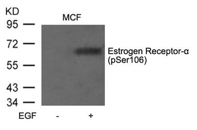 Western blot analysis of extracts from MCF7 cells untreated or treated with EGF using Estrogen Receptor-a(Phospho-Ser106) Antibody.Rabbit anti-Human ESR1 Polyclonal Antibody