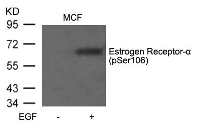 Western blot analysis of extracts from MCF7 cells untreated or treated with EGF using Estrogen Receptor-a(Phospho-Ser106) Antibody.Rabbit anti-Human ESR1 Polyclonal Antibody