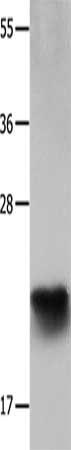 Gel: 12%SDS-PAGE, Lysate: 30 μg, Lane: Human colon cancer tissue, Primary antibody: IL18 Antibody(IL18 Antibody) at dilution 1/2000, Secondary antibody: Goat anti rabbit IgG at 1/8000 dilution, Exposure time: 1 minute