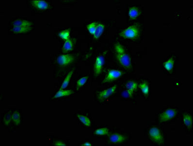 Immunofluorescence staining of Hela cells with LTBR Antibody at 1:60, counter-stained with DAPI. The cells were fixed in 4% formaldehyde, permeabilized using 0.2% Triton X-100 and blocked in 10% normal Goat Serum. The cells were then incubated with the antibody overnight at 4°C. The secondary antibody was Alexa Fluor 488-congugated AffiniPure Goat Anti-Rabbit IgG(H+L).