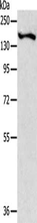 Gel: 10%SDS-PAGE, Lysate: 40 μg, Lane: Mouse brain tissue, Primary antibody: ROCK2 Antibody(ROCK2 Antibody) at dilution 1/400, Secondary antibody: Goat anti rabbit IgG at 1/8000 dilution, Exposure time: 1 minuteRabbit anti-Human ROCK2 Polyclonal Antibody