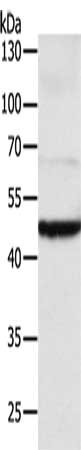 Gel: 10%SDS-PAGE, Lysate: 40 μg, Lane: Mouse brain tissue, Primary antibody: TEKT1 Antibody(TEKT1 Antibody) at dilution 1/500, Secondary antibody: Goat anti rabbit IgG at 1/8000 dilution, Exposure time: 10 minutesRabbit anti-Human TEKT1 Polyclonal Antibody
