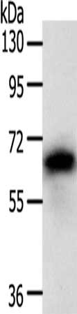 Gel: 10%SDS-PAGE, Lysate: 40 μg, Lane: PC3 cells, Primary antibody: SRC Antibody(SRC Antibody) at dilution 1/100, Secondary antibody: Goat anti rabbit IgG at 1/8000 dilution, Exposure time: 1 minuteRabbit anti-Human SRC Polyclonal Antibody