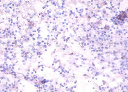 Immunohistochemistry of paraffin-embedded human spleen tissue using RELT Antibody at dilution of 1:100Rabbit anti-Human RELT Polyclonal Antibody