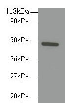 Western blot  | All lanes: RELT antibody at 2µg/ml + 293T whole cell lysate  | Secondary  | Goat polyclonal to rabbit IgG at 1/10000 dilution  | Predicted band size: 47 kDa  | Observed band size: 47 kDaRabbit anti-Human RELT Polyclonal Antibody
