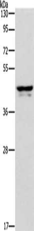 Gel: 10%SDS-PAGE, Lysate: 20 μg, Lane: Human plasma tissue, Primary antibody: APOL1 Antibody(APOL1 Antibody) at dilution 1/400, Secondary antibody: Goat anti rabbit IgG at 1/8000 dilution, Exposure time: 2 secondsRabbit anti-Human APOL1 Polyclonal Antibody
