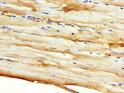 IHC image of DKK2 Antibody diluted at 1:500 and staining in paraffin-embedded human skeletal muscle tissue performed on a Leica BondTM system. After dewaxing and hydration, antigen retrieval was mediated by high pressure in a citrate buffer (pH 6.0). Section was blocked with 10% normal goat serum 30min at RT. Then primary antibody (1% BSA) was incubated at 4°C overnight. The primary is detected by a biotinylated secondary antibody and visualized using an HRP conjugated SP system.Rabbit anti-Human DKK2 Polyclonal Antibody