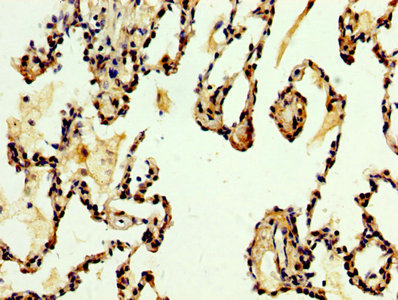 IHC image of DKK2 Antibody diluted at 1:500 and staining in paraffin-embedded human lung tissue performed on a Leica BondTM system. After dewaxing and hydration, antigen retrieval was mediated by high pressure in a citrate buffer (pH 6.0). Section was blocked with 10% normal goat serum 30min at RT. Then primary antibody (1% BSA) was incubated at 4°C overnight. The primary is detected by a biotinylated secondary antibody and visualized using an HRP conjugated SP system.Rabbit anti-Human DKK2 Polyclonal Antibody