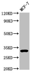 Western Blot  | Positive WB detected in: MCF-7 whole cell lysate  | All lanes: DKK2 antibody at 3.9μg/ml  | Secondary  | Goat polyclonal to rabbit IgG at 1/50000 dilution  | Predicted band size: 29 kDa  | Observed band size: 32 kDaRabbit anti-Human DKK2 Polyclonal Antibody