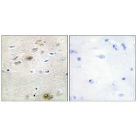 Immunohistochemistry analysis of paraffin-embedded human brain tissue using TRA-2α antibody.Rabbit anti-Human TRA2A Polyclonal Antibody